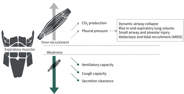Highlights from the Respiratory Failure and Mechanical Ventilation Conference 2024.
