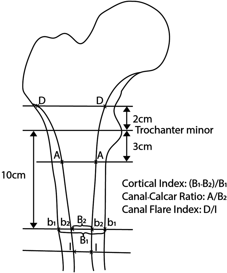 The cemented stem in hip arthroplasty - state of the art technique and recommendations.