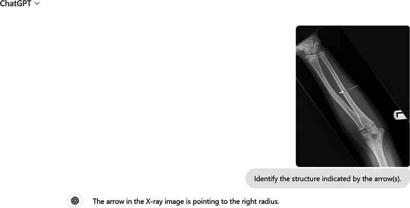 Evaluating ChatGPT-4's Performance in Identifying Radiological Anatomy in FRCR Part 1 Examination Questions.