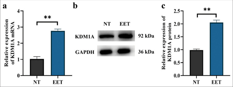Inhibition of lysine-specific histone demethylase 1A suppresses adenomyosis through reduction in ectopic endometrial stromal cell proliferation, migration, and invasion.