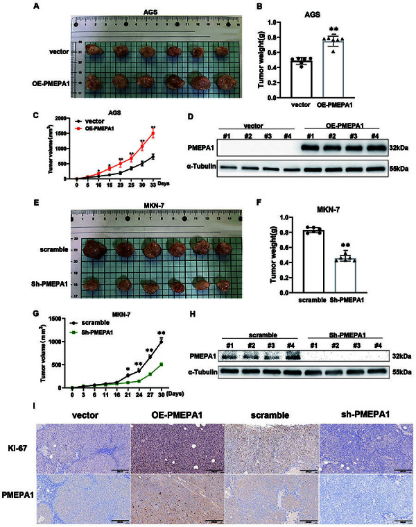 PMEPA1 promotes gastric cancer cell proliferation by regulating the ubiquitin-mediated degradation of 14-3-3σ and promoting cell cycle progression.