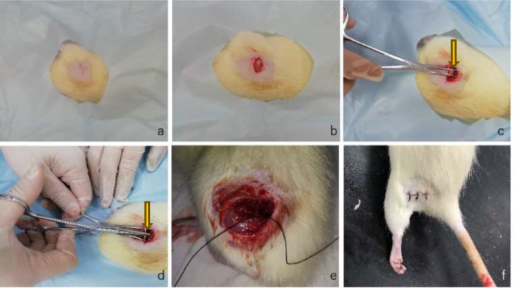 Effect and mechanism of Tetramethylpyrazine in repair of sciatic nerve injury in rats.