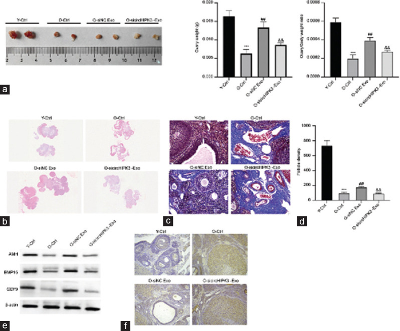 Adipose-derived stem cells exosomal circHIPK3 protects ovarian function by regulating MAPK signaling.