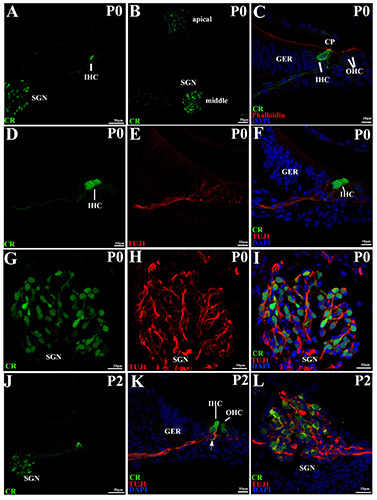 Developmental expression of calretinin in the mouse cochlea.