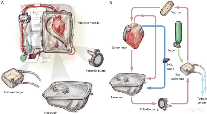 Surgical techniques for cardiac allograft procurement and perfusion in controlled donation after circulatory death.