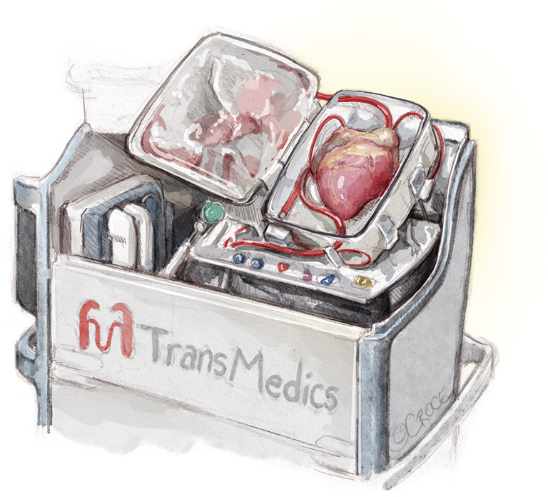 Surgical techniques for cardiac allograft procurement and perfusion in controlled donation after circulatory death.