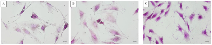 The Non-Linear Profile of Aging: U-Shaped Expression of Myostatin, Follistatin and Intermediate Signals in a Longitudinal In Vitro Murine Cell Sarcopenia Model.