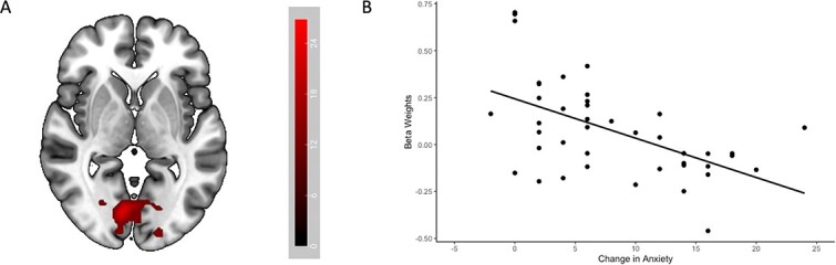 Comparative effects of topiramate and naltrexone on neural activity during anticipatory anxiety in individuals with alcohol use disorder.