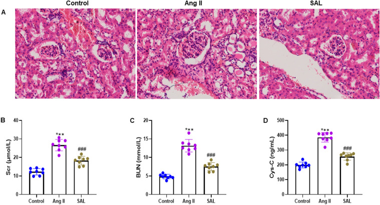Salidroside Pre-Treatment Inhibits Hypertensive Renal Injury and Fibrosis Through Inhibiting Wnt/β-Catenin Pathway.