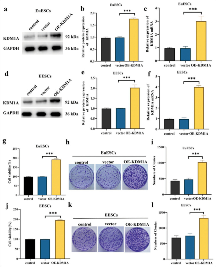 Inhibition of lysine-specific histone demethylase 1A suppresses adenomyosis through reduction in ectopic endometrial stromal cell proliferation, migration, and invasion.