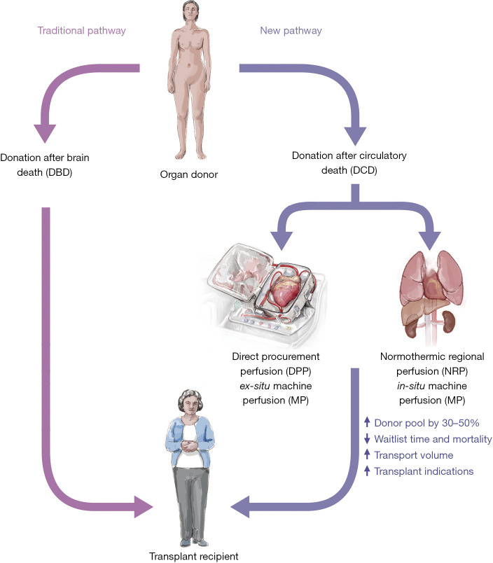 Surgical techniques for cardiac allograft procurement and perfusion in controlled donation after circulatory death.