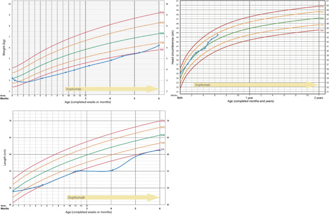 Dupilumab in a 9-week-old with Netherton Syndrome Leads to Deep Symptom Control.