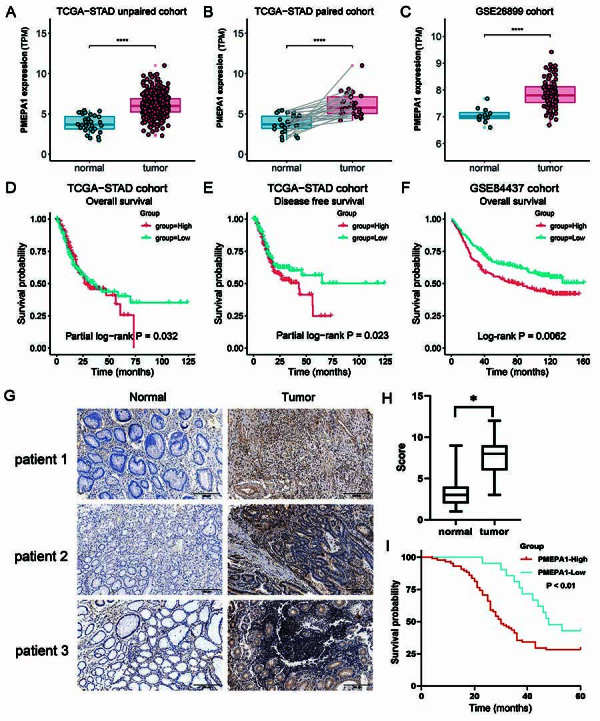 PMEPA1 promotes gastric cancer cell proliferation by regulating the ubiquitin-mediated degradation of 14-3-3σ and promoting cell cycle progression.