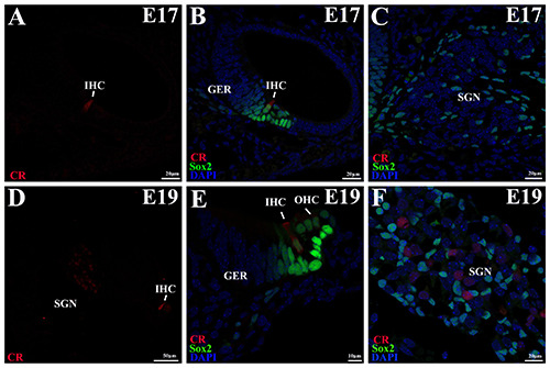 Developmental expression of calretinin in the mouse cochlea.
