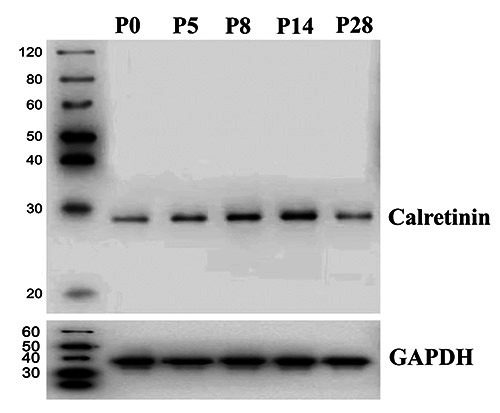 Developmental expression of calretinin in the mouse cochlea.
