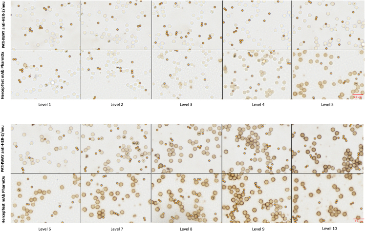 Comparing the Sensitivity of HER2 Epitope Detection of HercepTest mAb pharmDx (Dako Omnis, GE001) and Ventana PATHWAY Anti-HER-2/neu (4B5) Using IHC Calibrators.