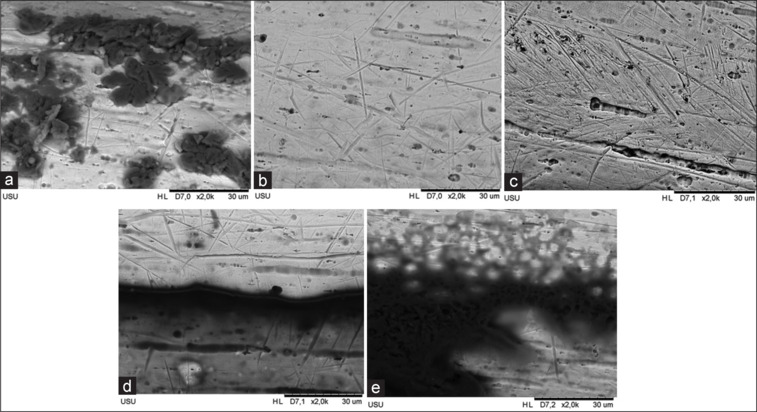 Changes in the corrosion rate and microstructure of nickel titanium wire in pandan leaves extract.