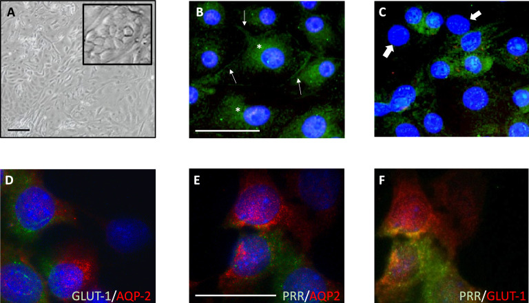 GLUT1 and prorenin receptor mediate differential regulation of TGF-β and CTGF in renal inner medullary collecting duct cells during high glucose conditions.