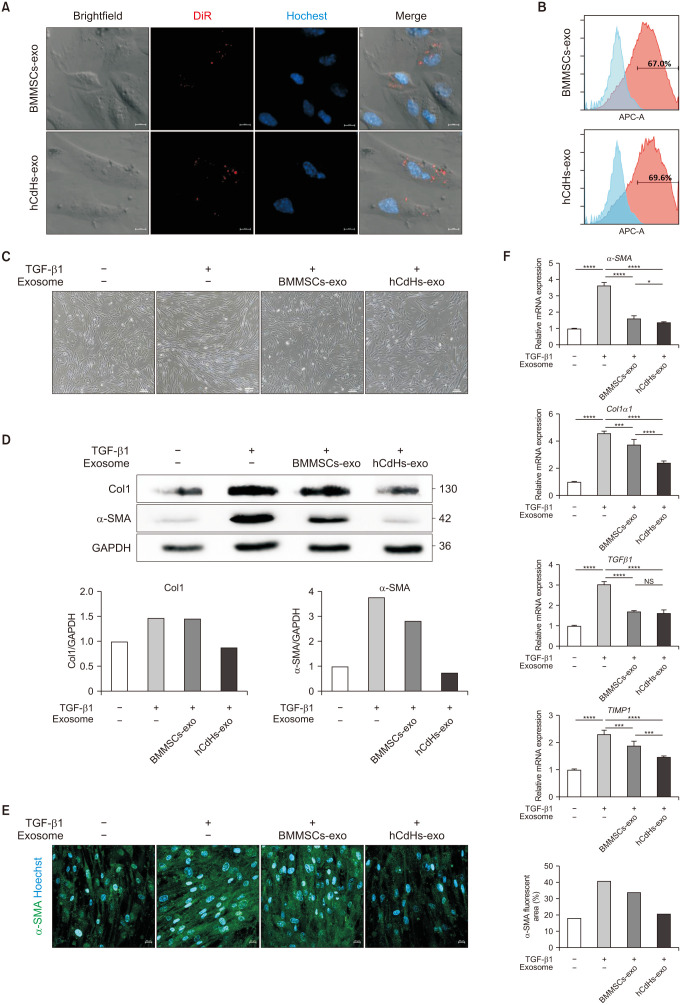 The efficacy of exosomes from human chemically derived hepatic progenitors in liver damage alleviation: a preclinical experimental study.