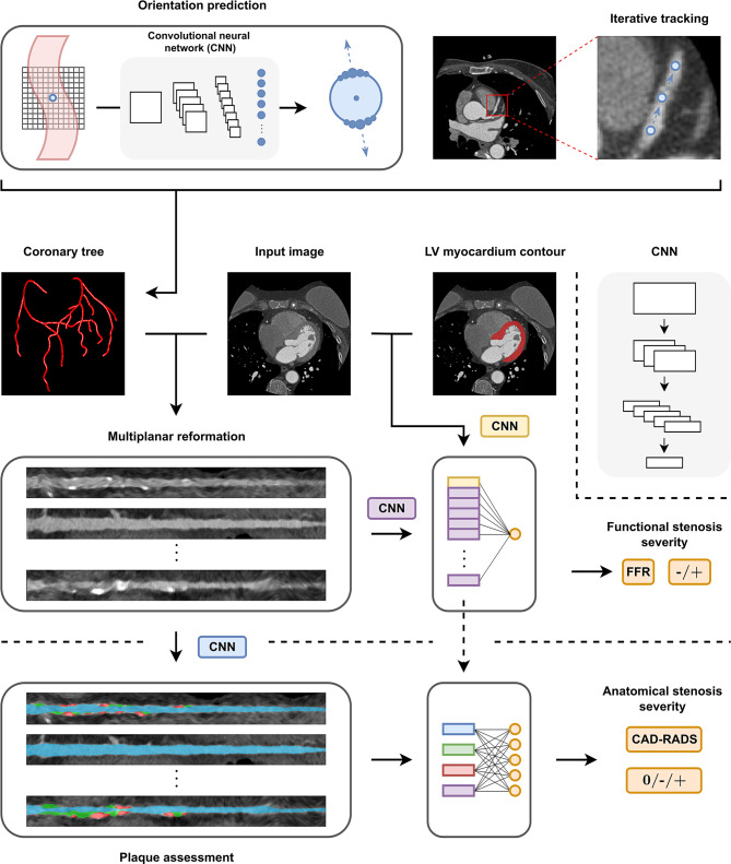 The role of artificial intelligence in coronary CT angiography.