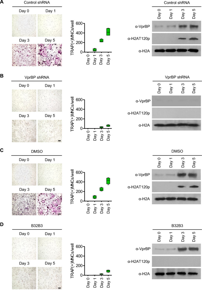 VprBP regulates osteoclast differentiation via an epigenetic mechanism involving histone H2A phosphorylation.