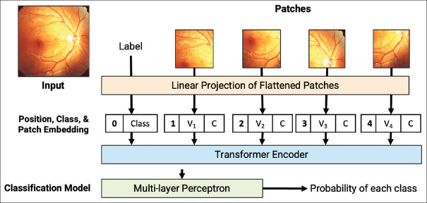 Discriminative, generative artificial intelligence, and foundation models in retina imaging.