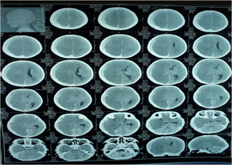 Abstract Image