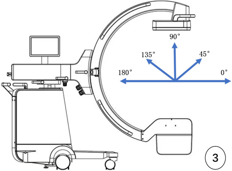 Intraoperative angulation of the C-arm for X-ray of each curved surface of the femoral neck wall: a cadaveric study.
