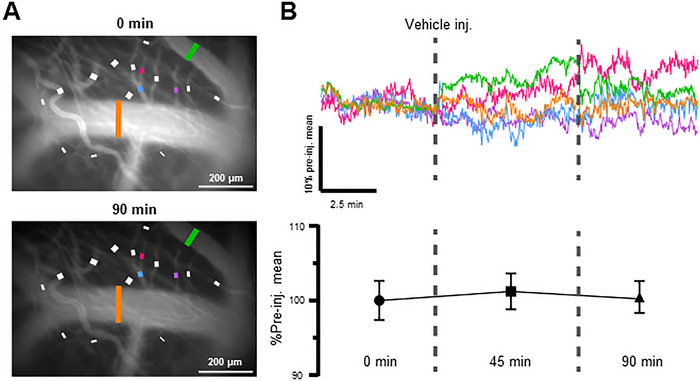 Harnessing Miniscope Imaging in Freely Moving Animals to Unveil Migraine Pathophysiology and Validate Novel Therapeutic Strategies.