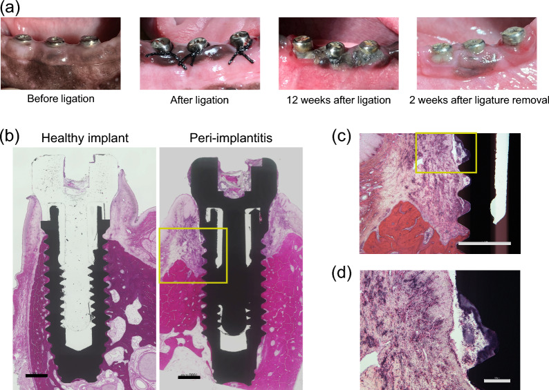 Brain-derived neurotrophic factor promotes bone regeneration in a canine model of peri-implantitis.