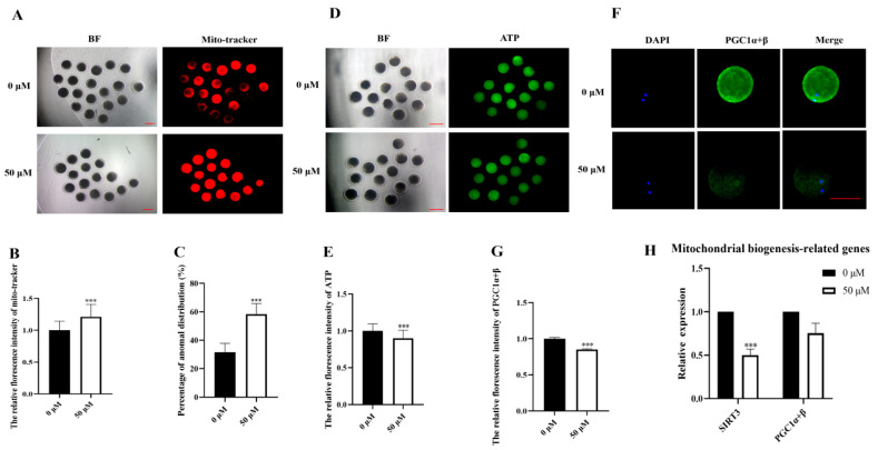 Methyl Paraben Affects Porcine Oocyte Maturation Through Mitochondrial Dysfunction.