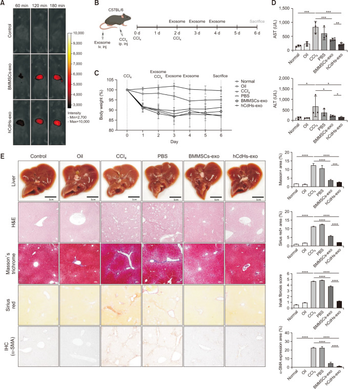 The efficacy of exosomes from human chemically derived hepatic progenitors in liver damage alleviation: a preclinical experimental study.