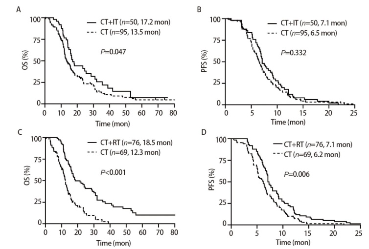 [Radiotherapy Combined with Immunotherapy and Chemotherapy Improves Prognosis and Demonstrates Synergistic Effects in Extensive-stage Small Cell Lung Cancer].