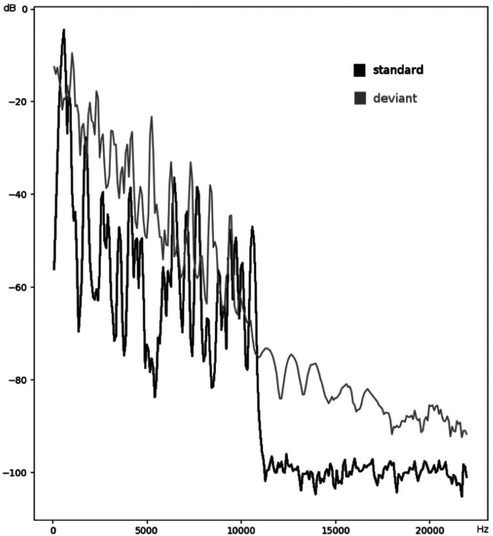 Pre-attentive and Attentive Auditory Event-related Potentials in Children With Attention-Deficit Hyperactivity Disorder and Autism.