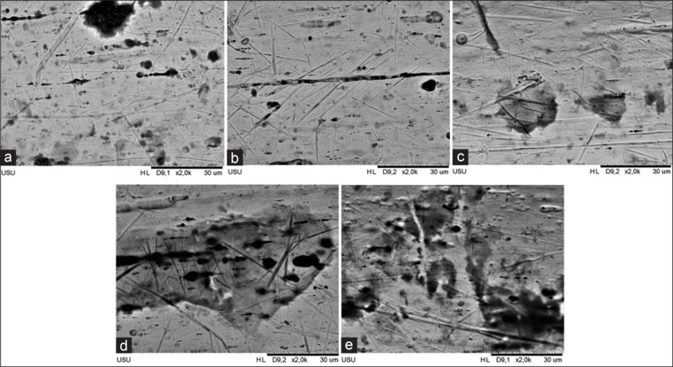 Changes in the corrosion rate and microstructure of nickel titanium wire in pandan leaves extract.