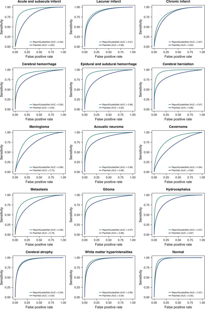 Boosting Deep Learning for Interpretable Brain MRI Lesion Detection through the Integration of Radiology Report Information.
