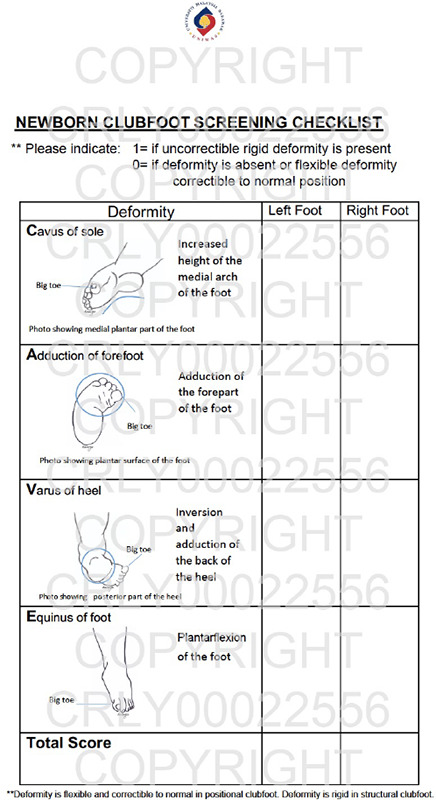 Development and validation of the Newborn Clubfoot Screening Checklist to improve the detection of postnatal congenital talipes equinovarus among newborns by non-orthopaedic-trained healthcare workers in Sarawak General Hospital: A cross-sectional prospective study.