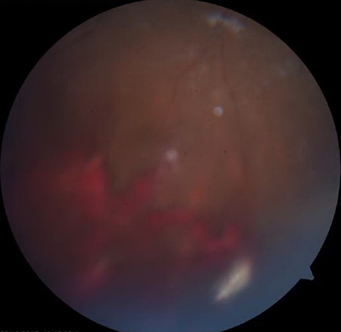 Abstract Image