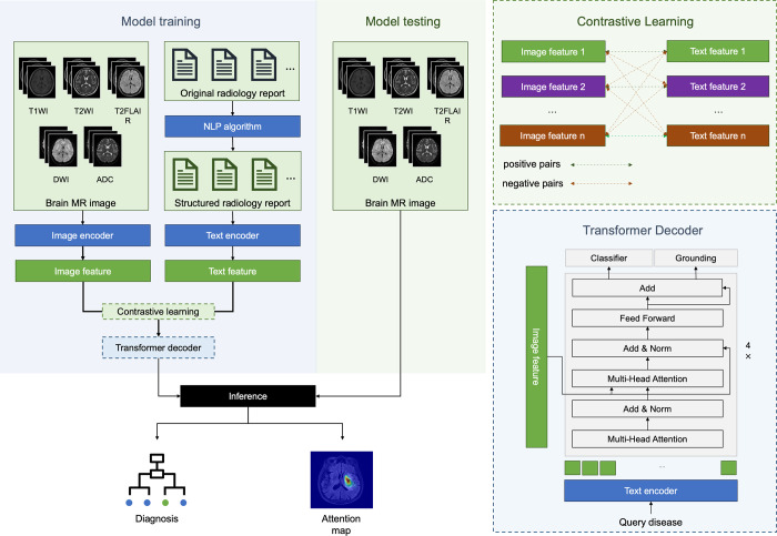 Boosting Deep Learning for Interpretable Brain MRI Lesion Detection through the Integration of Radiology Report Information.