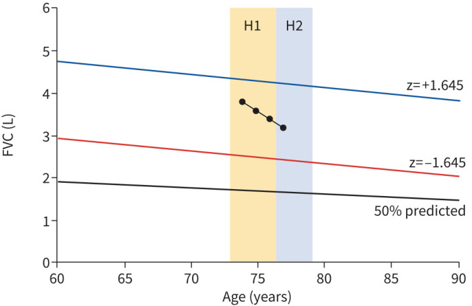 Integration of lung function data: turning snapshots into stories.