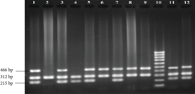 Role of GSTM1 and GSTT1 Gene Polymorphisms on Lung Cancer Susceptibility and Effect on Platinum-Based Chemotherapy-Induced Toxicity in Bangladeshi Lung Cancer Patients.
