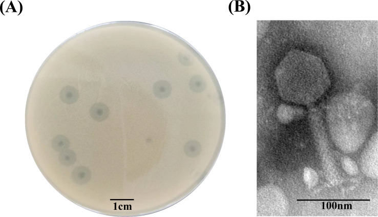 Characterization of phage HZY2308 against Acinetobacter baumannii and identification of phage-resistant bacteria.