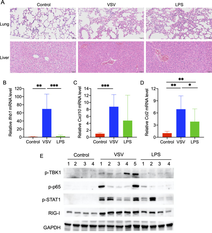 VSV infection and LPS treatment alter serum bile acid profiles, bile acid biosynthesis, and bile acid receptors in mice.
