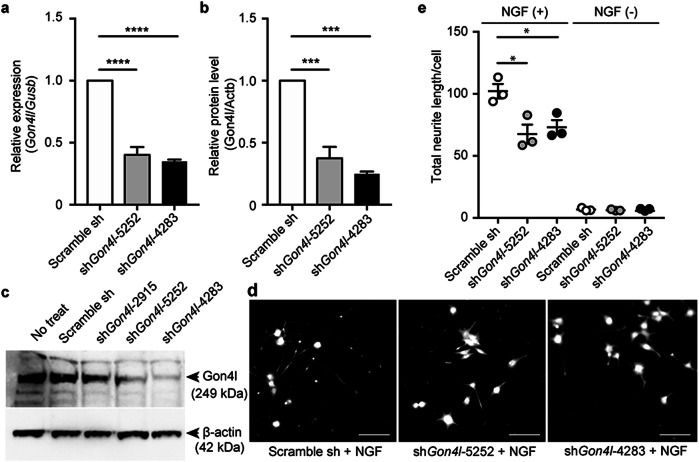 Biallelic loss-of-function variants in GON4L cause microcephaly and brain structure abnormalities.
