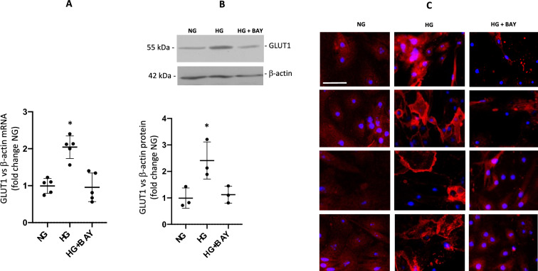 GLUT1 and prorenin receptor mediate differential regulation of TGF-β and CTGF in renal inner medullary collecting duct cells during high glucose conditions.