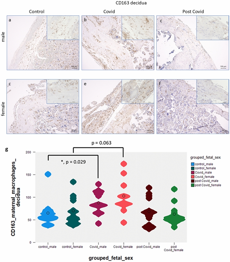 PD-L1 expression and characterization of its carrier macrophages in placentas with acute and specifically post-SARS-CoV-2 infection.