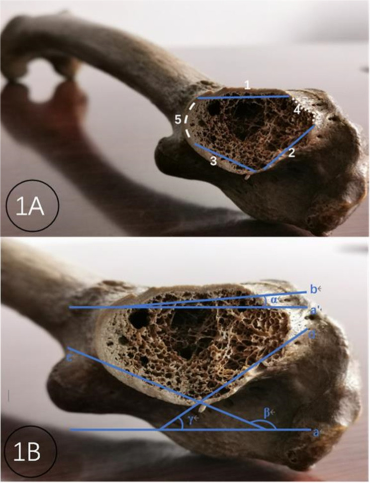 Intraoperative angulation of the C-arm for X-ray of each curved surface of the femoral neck wall: a cadaveric study.