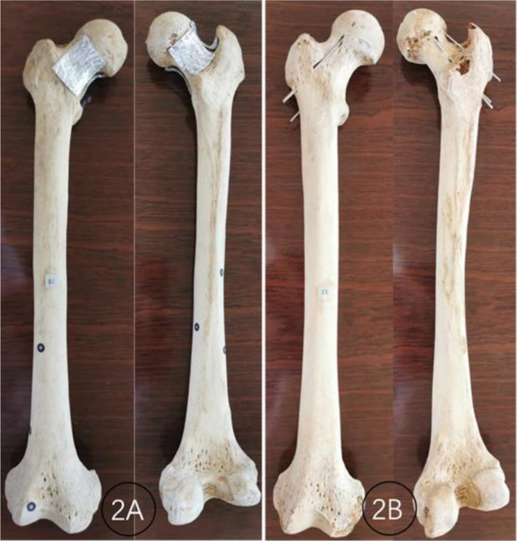 Intraoperative angulation of the C-arm for X-ray of each curved surface of the femoral neck wall: a cadaveric study.