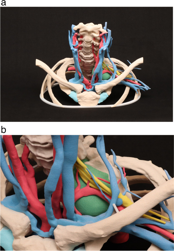 Stratifying complexity among the widespread use of 3D printing in United States health care facilities.