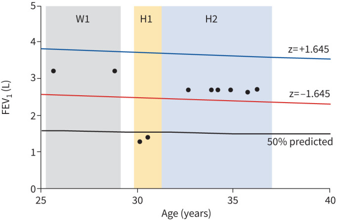 Integration of lung function data: turning snapshots into stories.